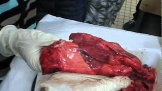 Respiration - Apport du dioxygène au sang - Vidéos pédagogiques - SVT : Secondaire 1